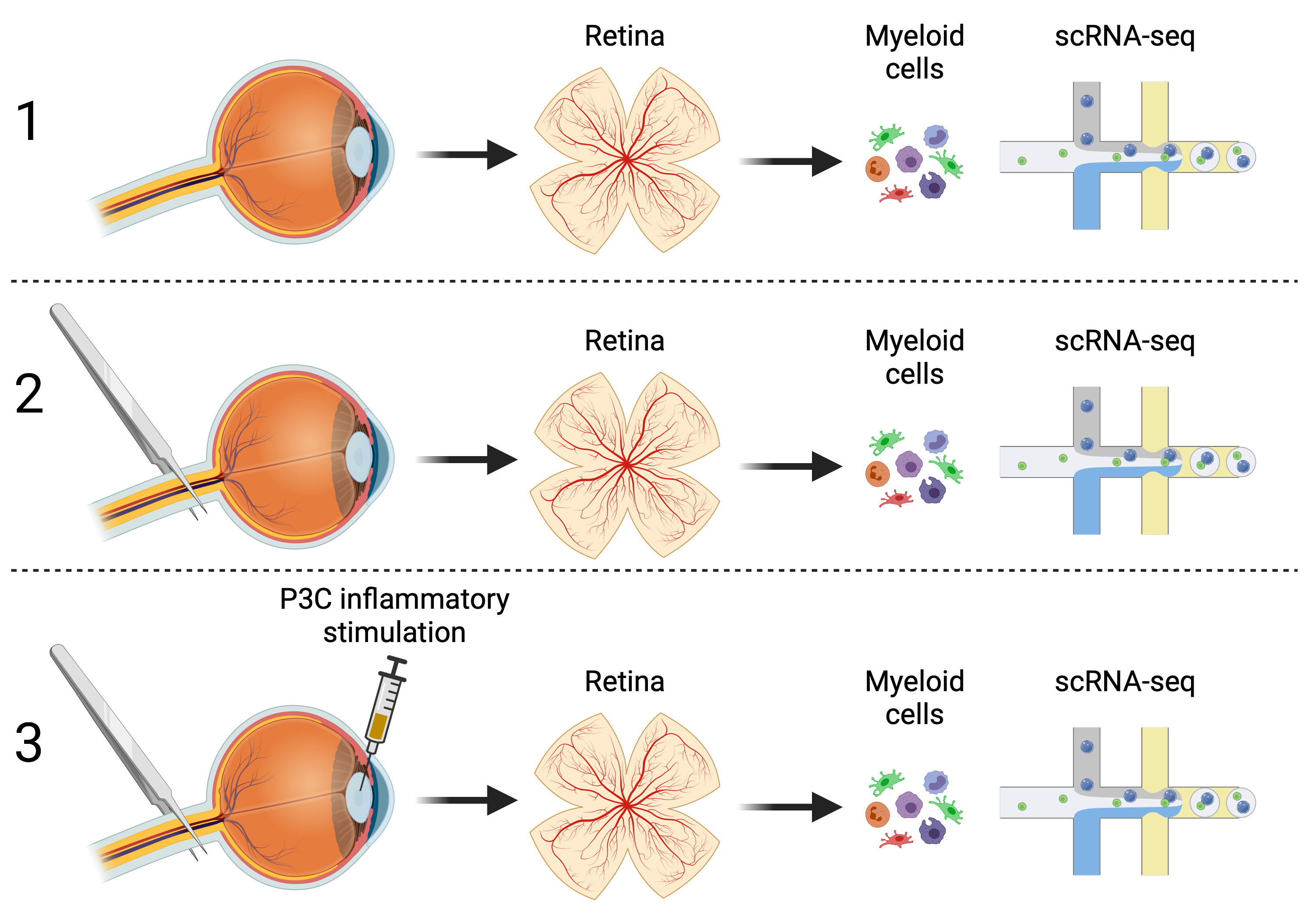 overview Retina